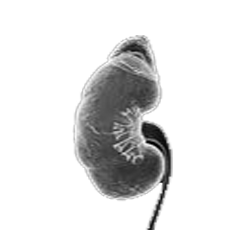 Wilms Tumor (Nephroblastoma)
